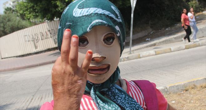 Savaş mağduru kız çocuğu maskeyle yaşıyor