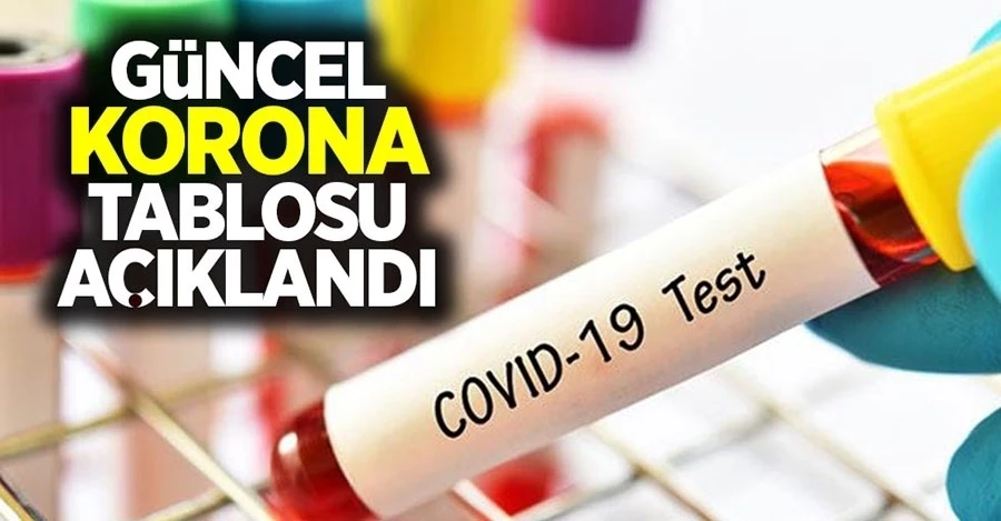 Günlük koronavirüs tablosu açıklandı!