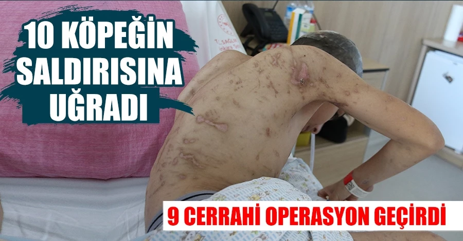 10 köpeğin saldırısına uğrayan 12 yaşındaki Enes, 9 cerrahi operasyon geçirdi, 6-7 tane daha geçirmesi planlanıyor   