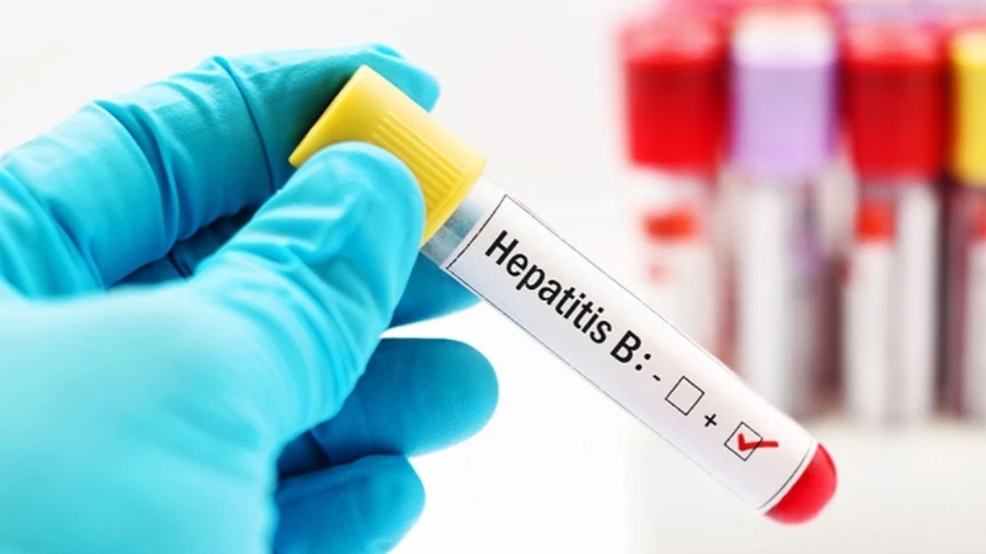 Gizemli hepatit hastalığı Japonya’da 2 çocukta daha görüldü