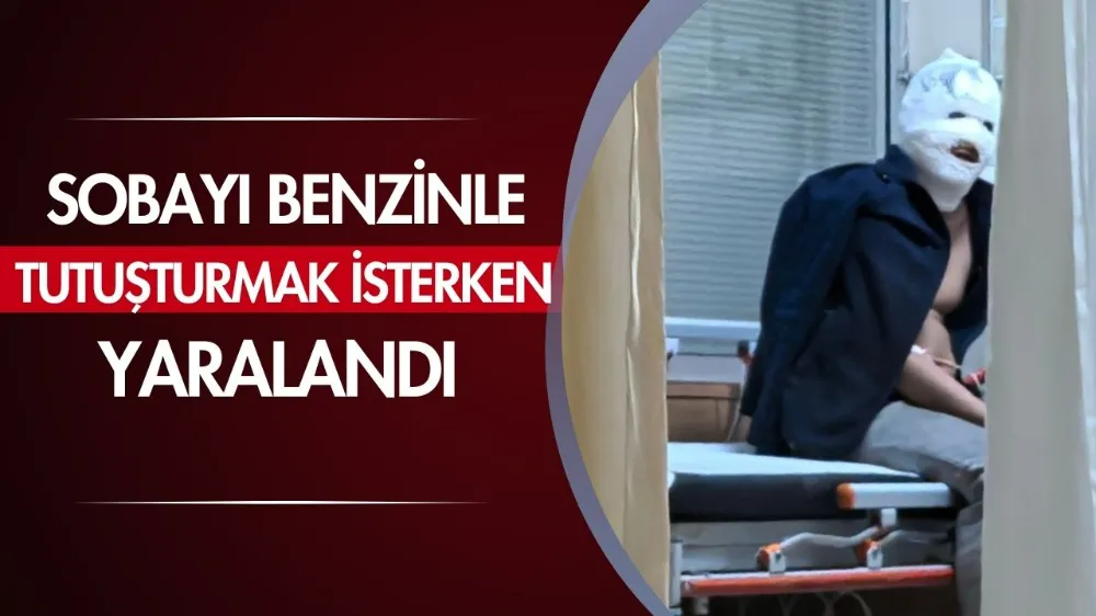  Sobayı benzinle tutuşturmak isterken yaralandı