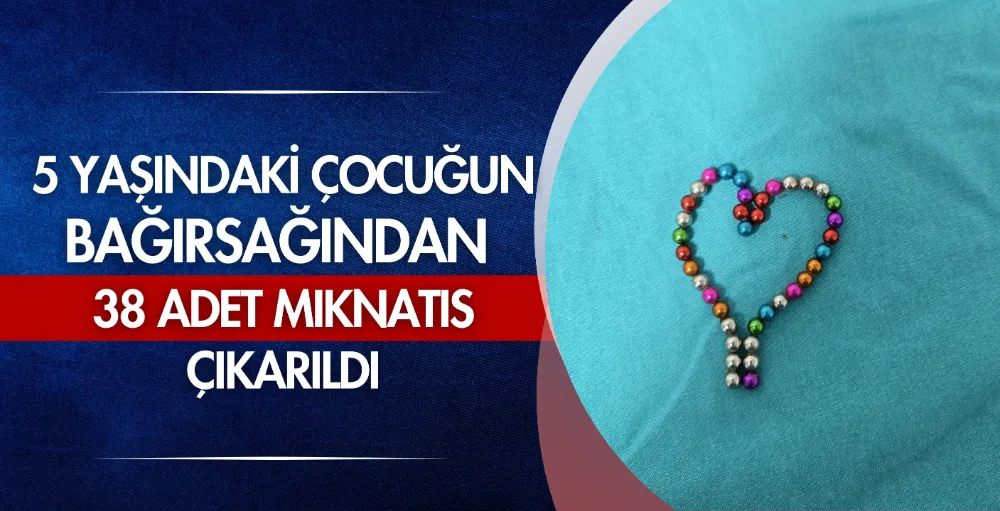 5 yaşındaki çocuğun bağırsağından 38 mıknatıs çıkartıldı