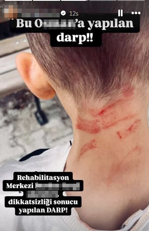 Rehabilitasyon merkezinde 5 yaşında çocuğa darp iddiasına soruşturma