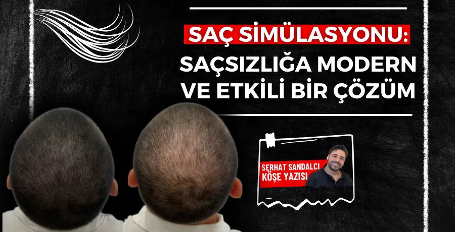 Saç simülasyonu: Saçsızlığa modern ve etkili bir çözüm